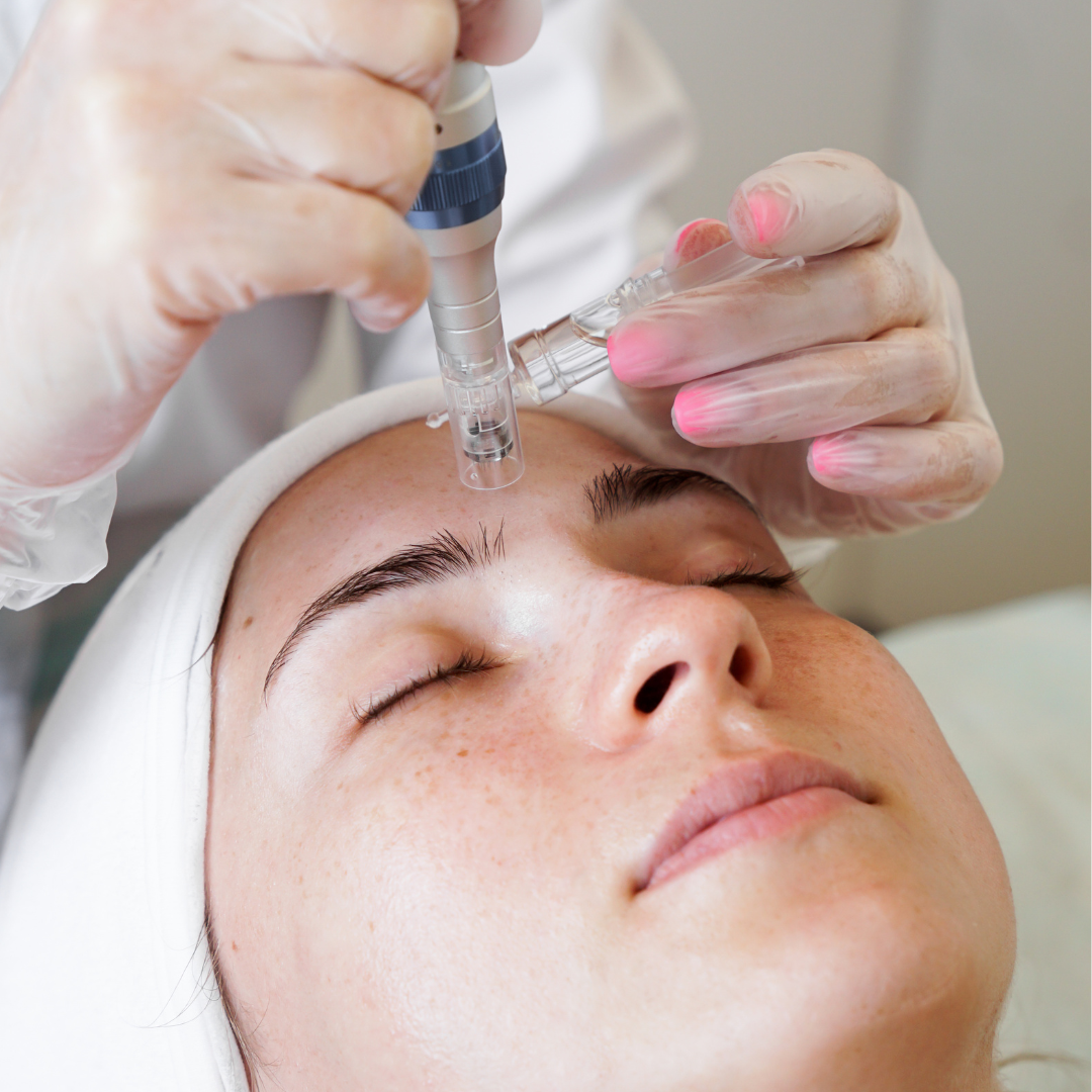 Brisbane Skin needling